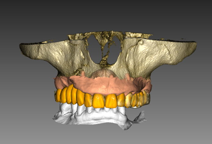 Ceratura